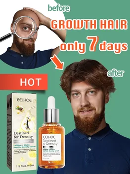 Восстановление волосяных фолликулов, Растительное эфирное масло для роста волос, быстрая регенерация волосяного покрова, средство для ухода за волосами и кожей головы